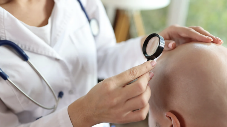 Understanding Hair Loss